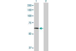 Western Blot analysis of FGFR1 expression in transfected 293T cell line by FGFR1 MaxPab polyclonal antibody. (FGFR1 anticorps  (AA 1-731))