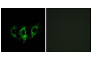 Immunofluorescence analysis of A549 cells, using GFM2 antibody. (GFM2 anticorps  (Internal Region))
