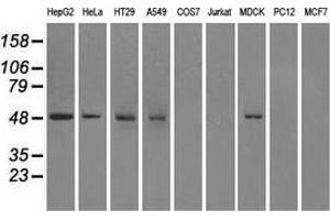 Western blot analysis of extracts (35 µg) from 9 different cell lines by using anti-FH monoclonal antibody. (FH anticorps)
