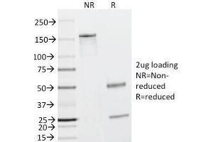 SDS-PAGE Analysis Purified Caldesmon Mouse Monoclonal Antibody (h-CALD). (Caldesmon anticorps)