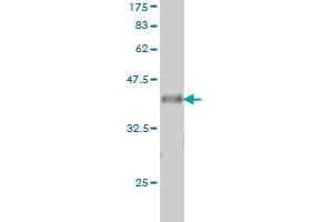 Western Blot detection against Immunogen (37.