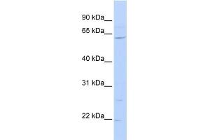 WB Suggested Anti-ZNF680 Antibody Titration:  0. (ZNF680 anticorps  (N-Term))