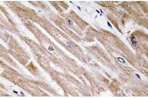 Immunohistochemistry analysis of BMP-5 Antibody in paraffin-embedded human heart tissue. (BMP5 anticorps)