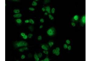 Immunofluorescence (IF) image for anti-Tumor Protein P53 (TP53) antibody (ABIN1499968) (p53 anticorps)