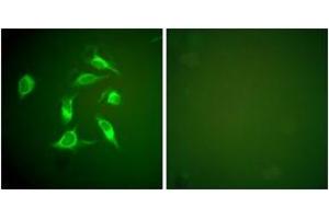 Immunofluorescence analysis of HeLa cells, using PDGFR alpha Antibody. (PDGFRA anticorps  (AA 1031-1080))