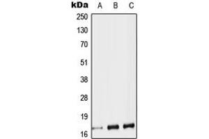 Western blot analysis of Protachykinin 1 expression in HEK293T (A), SP2/0 (B), H9C2 (C) whole cell lysates. (TAC1 anticorps  (Center))