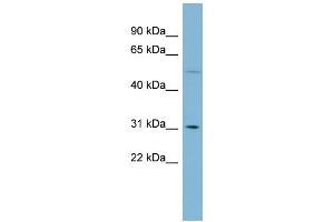 WB Suggested Anti-MRPL28 Antibody Titration: 0. (MRPL28 anticorps  (Middle Region))