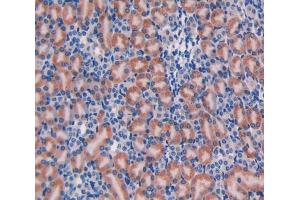Used in DAB staining on fromalin fixed paraffin-embedded Liver tissue (Galanin anticorps  (AA 36-123))
