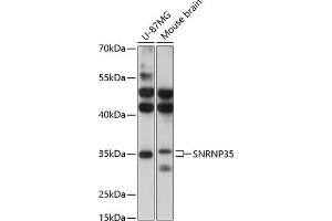 Western blot analysis of extracts of various cell lines, using SNRNP35 antibody (ABIN6132757, ABIN6148206, ABIN6148207 and ABIN6217126) at 1:3000 dilution. (SNRNP35 anticorps  (AA 1-150))