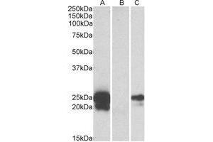 Western Blotting (WB) image for anti-WAP Four-Disulfide Core Domain 2 (WFDC2) (Internal Region) antibody (ABIN2464648)