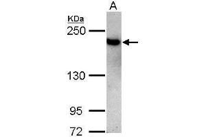WB Image Sample (30 ug of whole cell lysate) A: Jurkat 5% SDS PAGE antibody diluted at 1:3000 (TOP2B anticorps  (C-Term))