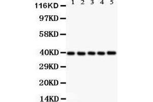 Anti- CXCR6 antibody,  Western blotting All lanes: Anti CXCR6 () at 0. (CXCR6 anticorps  (C-Term))