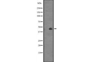 Western blot analysis of CANT1 expression in Jurkat cell line lysates,The lane on the left is treated with the antigen-specific peptide.