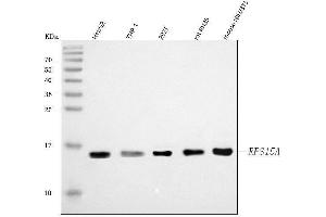 Western blot analysis of RPS15A using anti-RPS15A antibody (ABIN7598954).