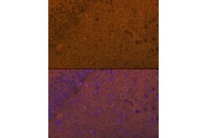 Immunofluorescence analysis of rat brain cells using GluR1/GRI Rabbit pAb (826) at dilution of 1:100 (40x lens).