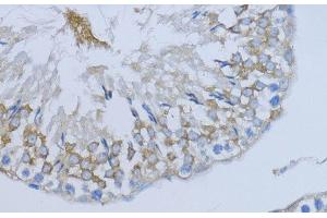 Immunohistochemistry of paraffin-embedded Rat testis using NRG4 Polyclonal Antibody at dilution of 1:200 (40x lens).