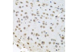 Immunohistochemistry of paraffin-embedded mouse brain using ELAVL1 antibody.