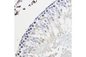 Immunohistochemistry of paraffin-embedded Rat testis using hnRNP U Rabbit pAb (ABIN1680323, ABIN3018279, ABIN3018280 and ABIN6220424) at dilution of 1:50 (40x lens).