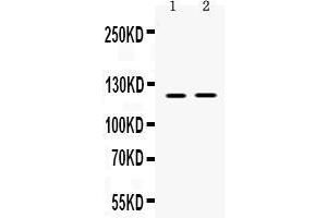 Western blot analysis of Ceruloplasmin expression in rat skeletal muscle extract ( Lane 1), and NIH3T3 whole cell lysates ( Lane 2). (Ceruloplasmin anticorps  (AA 20-258))