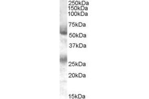 Western Blotting (WB) image for anti-Annexin A13 (ANXA13) (C-Term) antibody (ABIN2775608) (Annexin A13 anticorps  (C-Term))