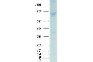 Validation with Western Blot