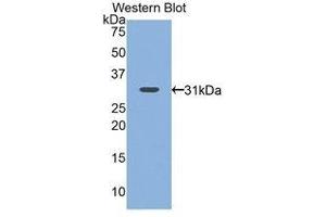 Western Blotting (WB) image for anti-Nicotinamide N-Methyltransferase (NNMT) (AA 1-258) antibody (ABIN1860015)