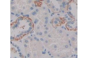 IHC-P analysis of Human Tissue, with DAB staining. (CYP1B1 anticorps  (AA 374-516))