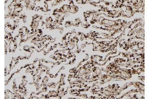 ABIN6272508 at 1/100 staining Human lung tissue by IHC-P.