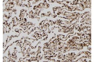 ABIN6272508 at 1/100 staining Human lung tissue by IHC-P. (MAGEA8 anticorps  (C-Term))