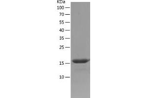 Western Blotting (WB) image for Calcium Binding tyrosine-(Y)-phosphorylation Regulated (CABYR) (AA 26-150) protein (His tag) (ABIN7122087)