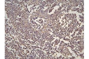 IHC analysis of HOOK3 using anti-HOOK3 antibody (ABIN6719547). (HOOK3 anticorps  (AA 14-198))
