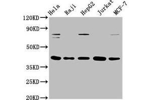 Western Blot Positive WB detected in: Hela whole cell lysate, Raji whole cell lysate, HepG2 whole cell lysate, Jurkat whole cell lysate, MCF-7 whole cell lysate All lanes: FEN1 antibody at 0. (Recombinant FEN1 anticorps)