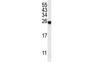 Western blot analysis of SPR antibody and mouse liver tissue lysate.