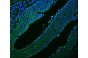 IF analysis of Citrin/SLC25A13 using anti-Citrin/SLC25A13 antibody (ABIN7599512). (slc25a13 anticorps  (AA 1-643))