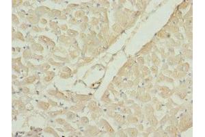 Immunohistochemistry of paraffin-embedded human heart tissue using ABIN7167204 at dilution of 1:100