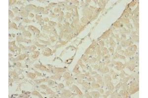 Immunohistochemistry of paraffin-embedded human heart tissue using ABIN7167204 at dilution of 1:100 (RAC3 anticorps  (AA 1-192))