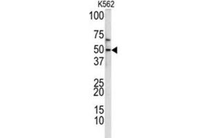 Western Blotting (WB) image for anti-Kruppel-Like Factor 11 (KLF11) antibody (ABIN3002716) (KLF11 anticorps)