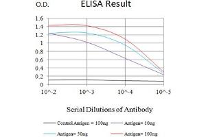 Black line: Control Antigen (100 ng),Purple line: Antigen (10 ng), Blue line: Antigen (50 ng), Red line:Antigen (100 ng) (SARS-Cov2-NP2 (AA 120-300) anticorps)