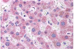 Human Liver: Formalin-Fixed, Paraffin-Embedded (FFPE)