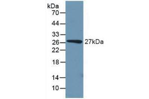 Western blot analysis of recombinant Mouse PCK1. (PCK1 anticorps  (AA 312-563))