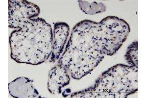 Immunoperoxidase of monoclonal antibody to HEXIM1 on formalin-fixed paraffin-embedded human placenta.