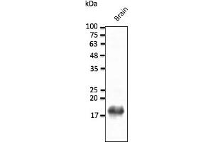 Western Blotting (WB) image for anti-Synuclein, beta (SNCB) (C-Term) antibody (ABIN7273028) (beta Synuclein anticorps  (C-Term))