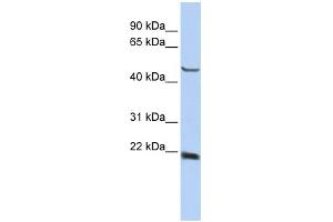 WB Suggested Anti-SSX4 Antibody Titration:  0. (SSX4 anticorps  (Middle Region))
