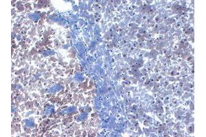 PICK1 Immunohistochemistry.