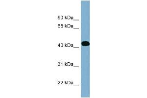 WB Suggested Anti-ITPK1 Antibody Titration: 0. (ITPK1 anticorps  (Middle Region))