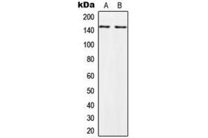 Western blot analysis of PALLD expression in HeLa (A), PC3 (B) whole cell lysates. (PALLD anticorps  (Center))