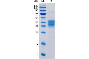 Human CD52 Protein, mFc Tag on SDS-PAGE under reducing condition.