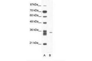 Image no. 1 for anti-E3 Ubiquitin-Protein Ligase SIAH1 (SIAH1) (N-Term) antibody (ABIN203050)