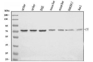 Western blot analysis of C5 using anti-C5 antibody (ABIN7600410).