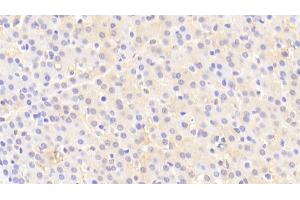 Detection of MMP13 in Human Liver Tissue using Polyclonal Antibody to Matrix Metalloproteinase 13 (MMP13)